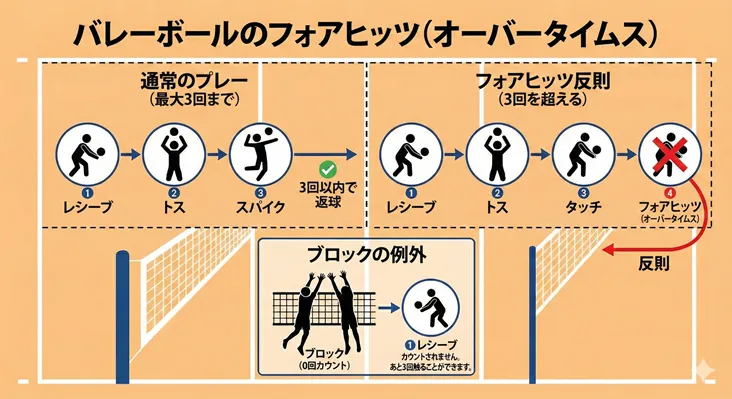 バレーボールのフォアヒッツ（オーバータイムス）ルールの図解。3回以内の通常プレー（レシーブ・トス・スパイク）と、4回触れる反則の違いを比較。ブロックは0カウント扱いで、その後さらに3回触れる例外ルールも解説。